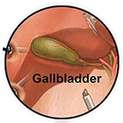 Gallbladder Surgery with Dr. Debashish Das is one of the best Laparoscopic, Endoscopic & General Surgeon in Chembur, Mumbai.